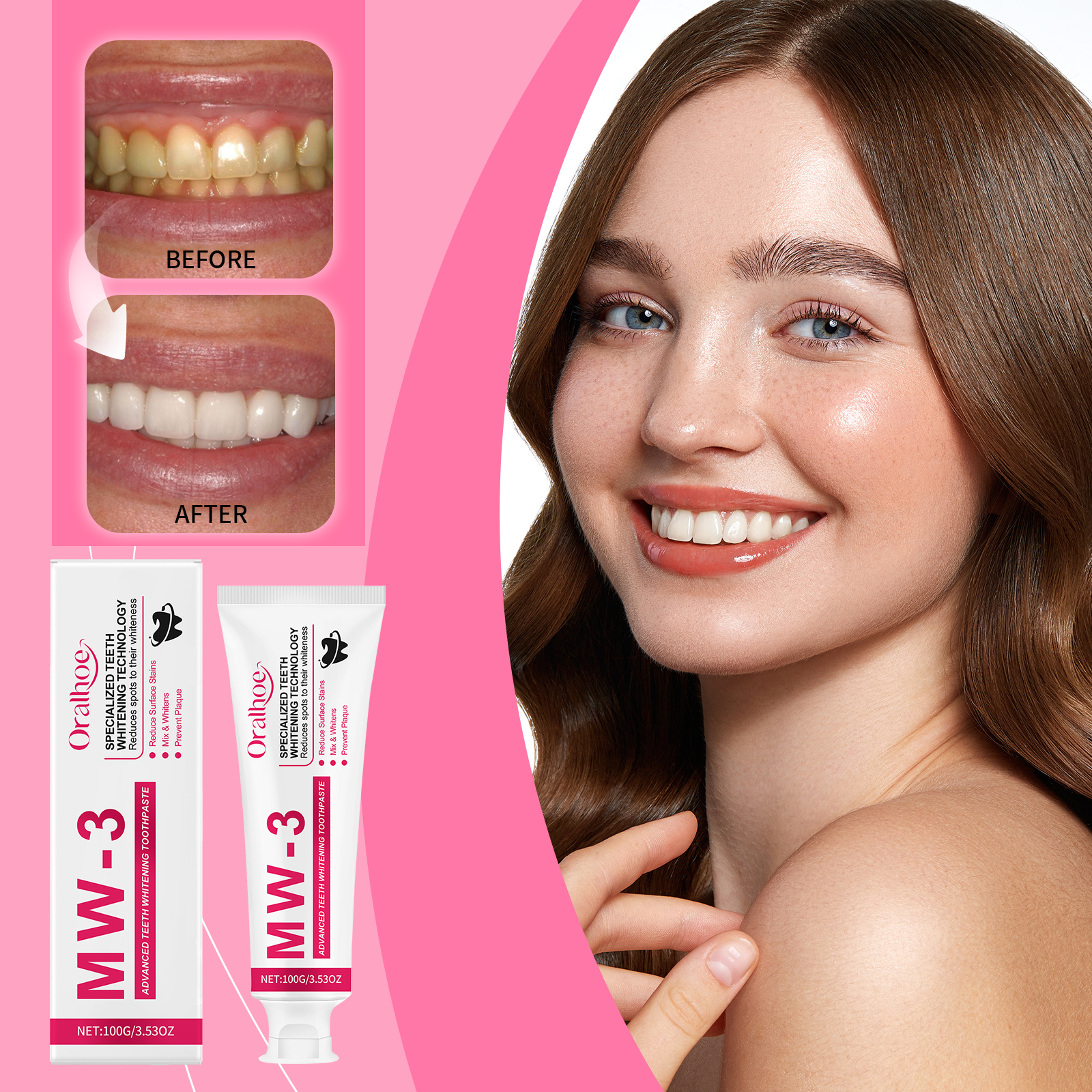 ORALHOE Advanced Teeth Whiteni - Teeth Whitening Or Tooth Whitening 评论和价格