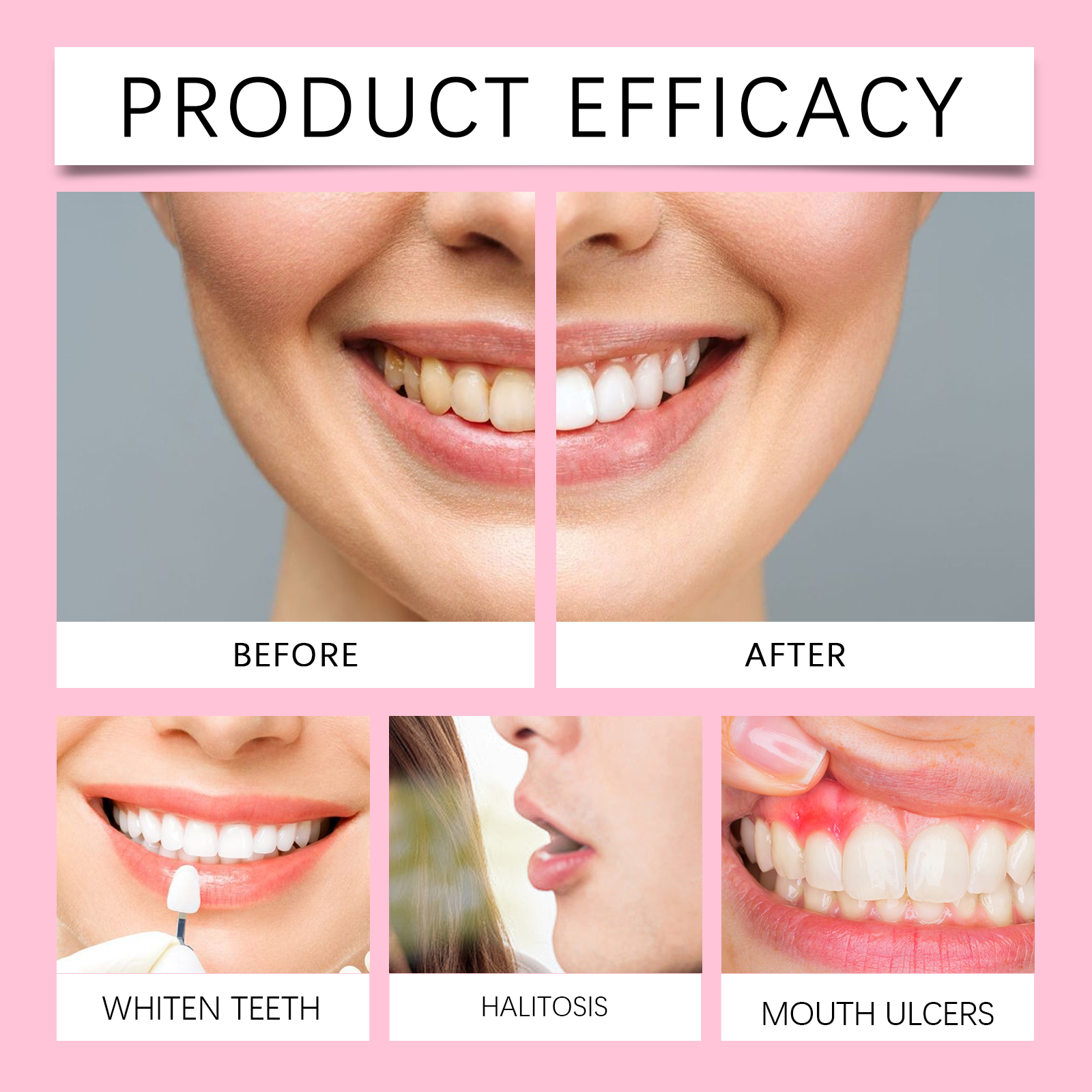 ORALHOE Advanced Teeth Whiteni - Teeth Whitening Or Tooth Whitening 评论和价格