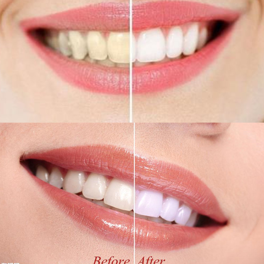 Bamboo Charcoal Teeth Tooth De - Teeth Whitening Diy 评论和价格