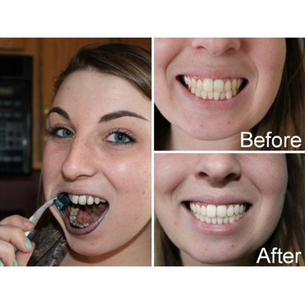 Bamboo Charcoal Teeth Tooth De - Teeth Whitening Diy 评论和价格