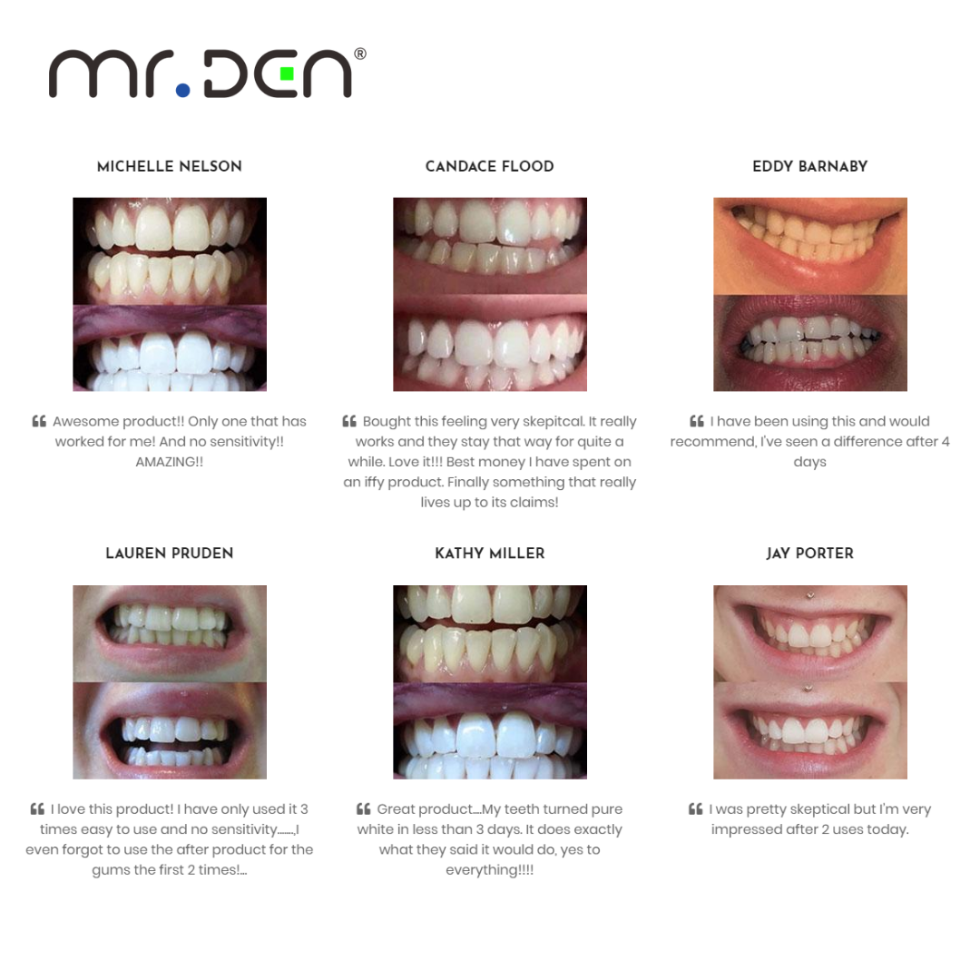 Dr. Whiten 3 Pack Teeth Whiten - Teeth Whitening Kit With Light 评论和价格