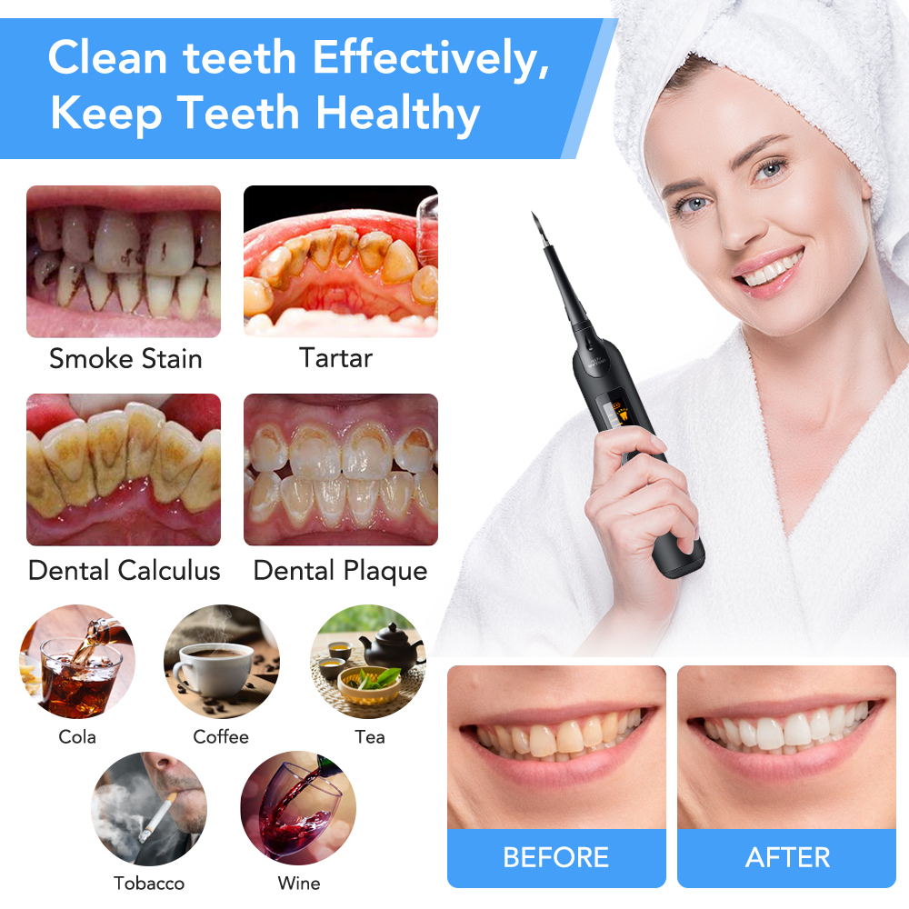 Teeth Tartar Remover Electric  - Teeth Whitening Kit With Light 评论和价格