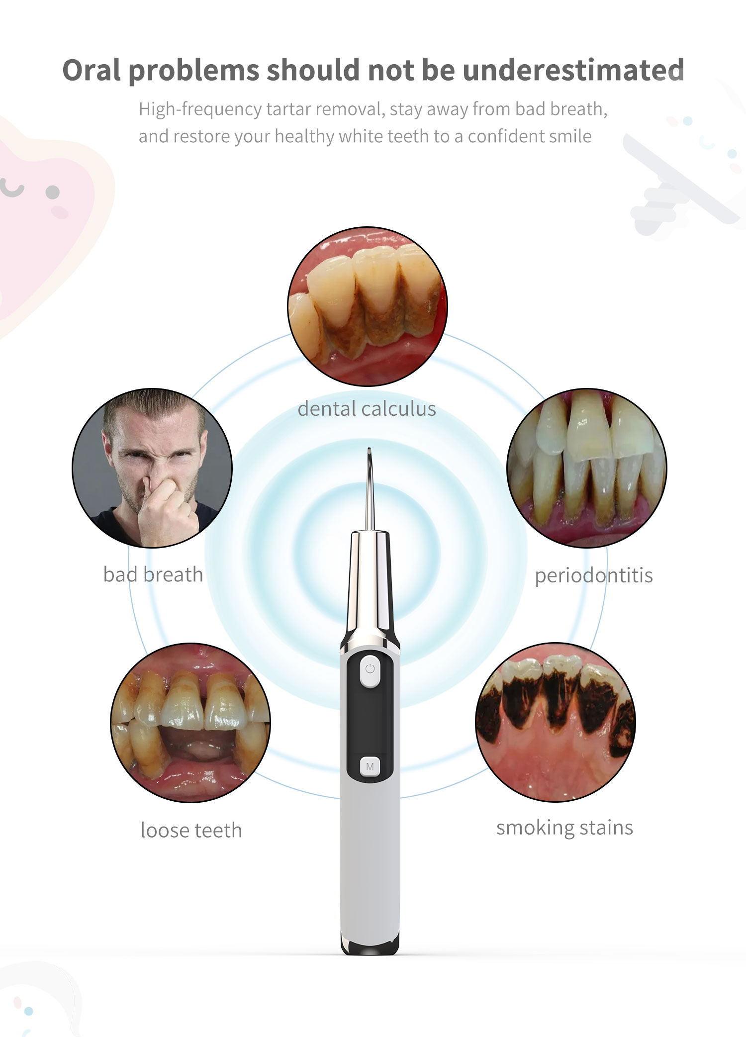 Electric Sonic Dental Calculus - Teeth Whitening Or Tooth Whitening 评论和价格