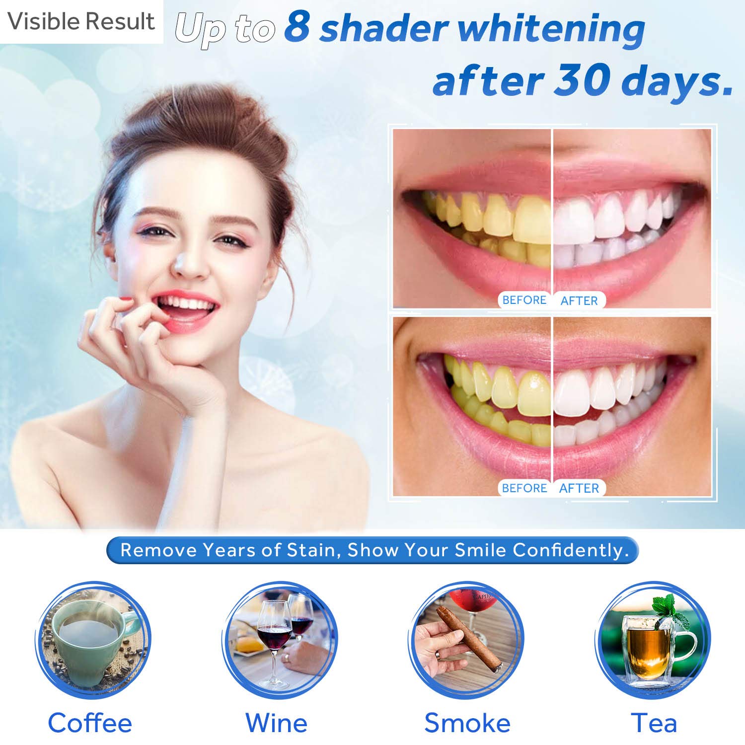 Teeth Whitening Gel Refill Syr - Teeth Whitening Diy 评论和价格