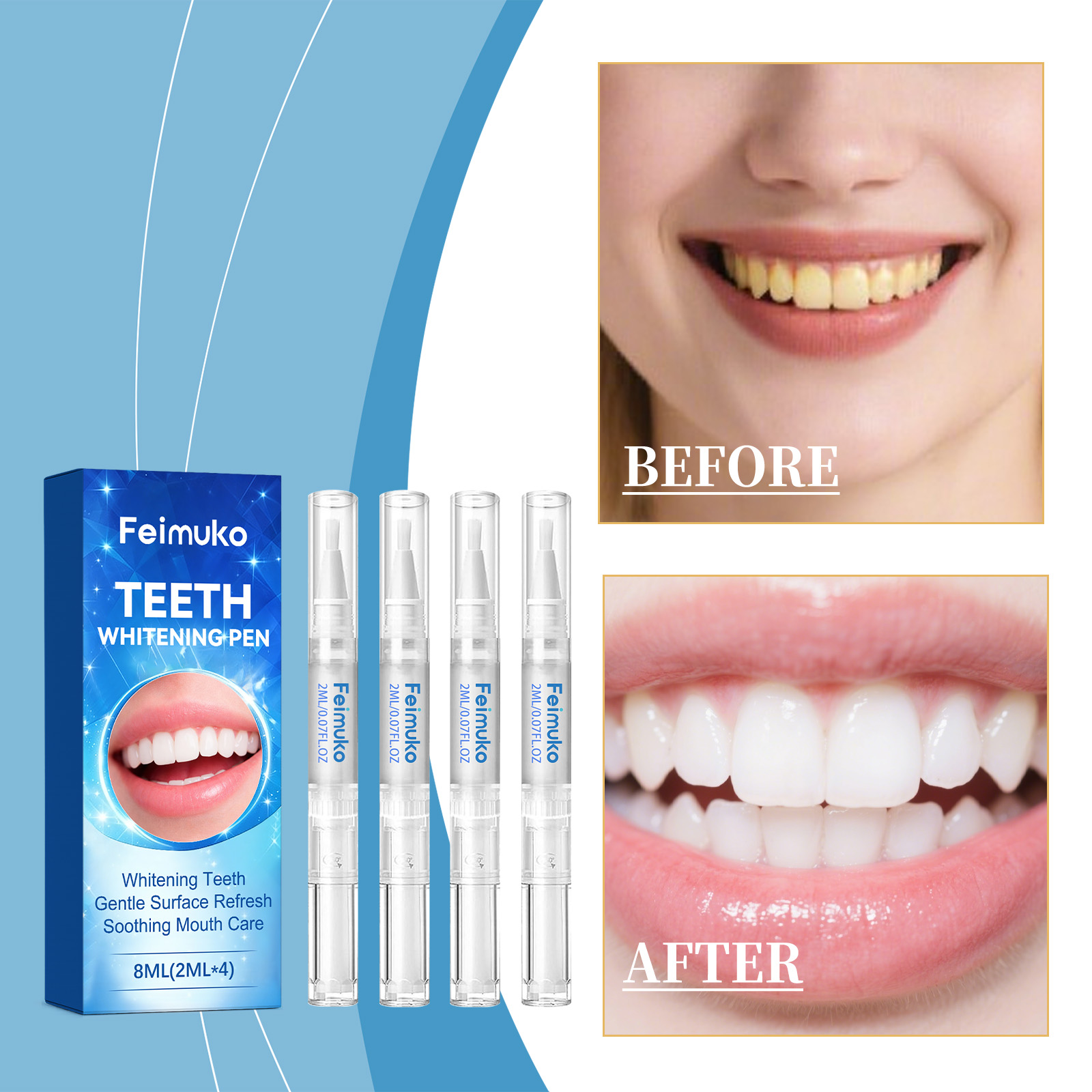 Feimuko 8ml Teeth Gel Pen Gent - Teeth Whitening Diy 评论和价格