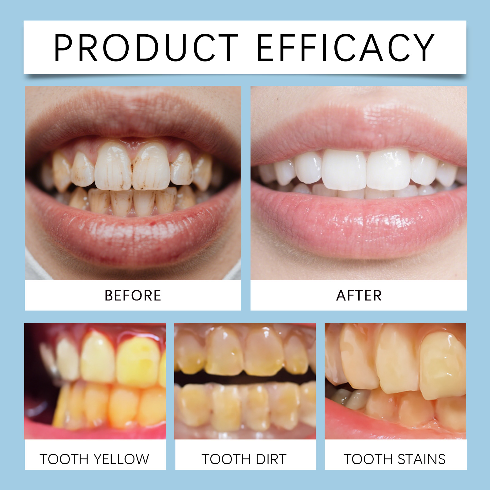 Feimuko 8ml Teeth Gel Pen Gent - Teeth Whitening Diy 评论和价格