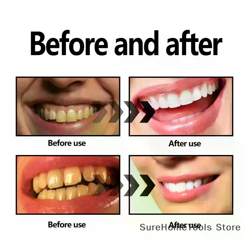 Bamboo Charcoal Powder For Tee - Teeth Whitening Diy 评论和价格