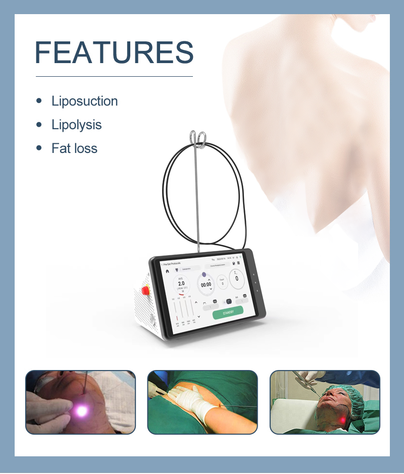Dental Laser Teeth Whitening D - Teeth Whitening Laser 评论和价格