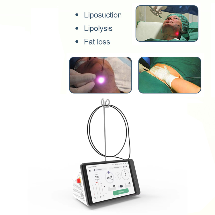 Dental Laser Teeth Whitening D - Teeth Whitening Laser 评论和价格