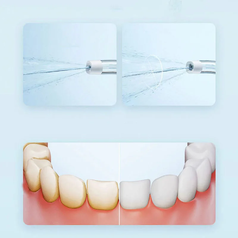 Xiaomi Portable Oral Irrigator - Teeth Whitening Or Tooth Whitening 评论和价格