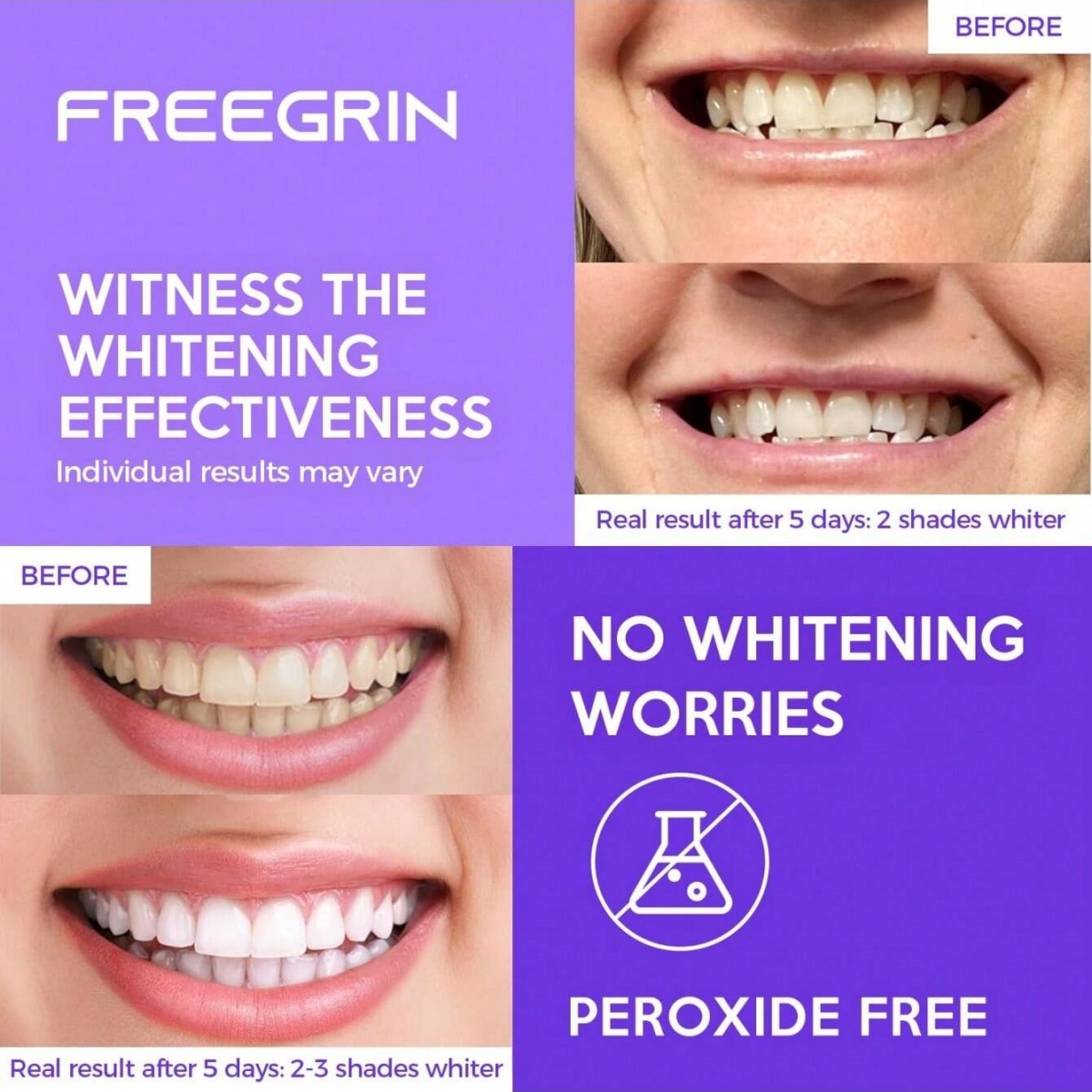 Deluxe Whitening Teeth Sticker - Teeth Whitening Diy 评论和价格