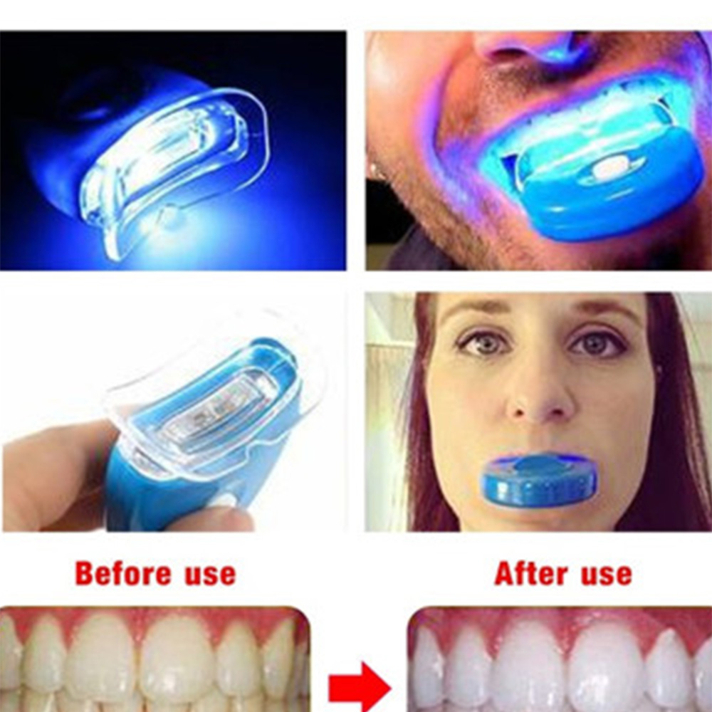 New Blue Led Teeth Whitening A - Teeth Whitening Laser 评论和价格