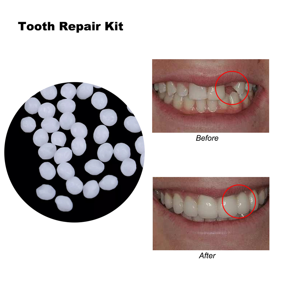 10/100g DIY Dentures Teether T - Teeth Whitening Diy 评论和价格