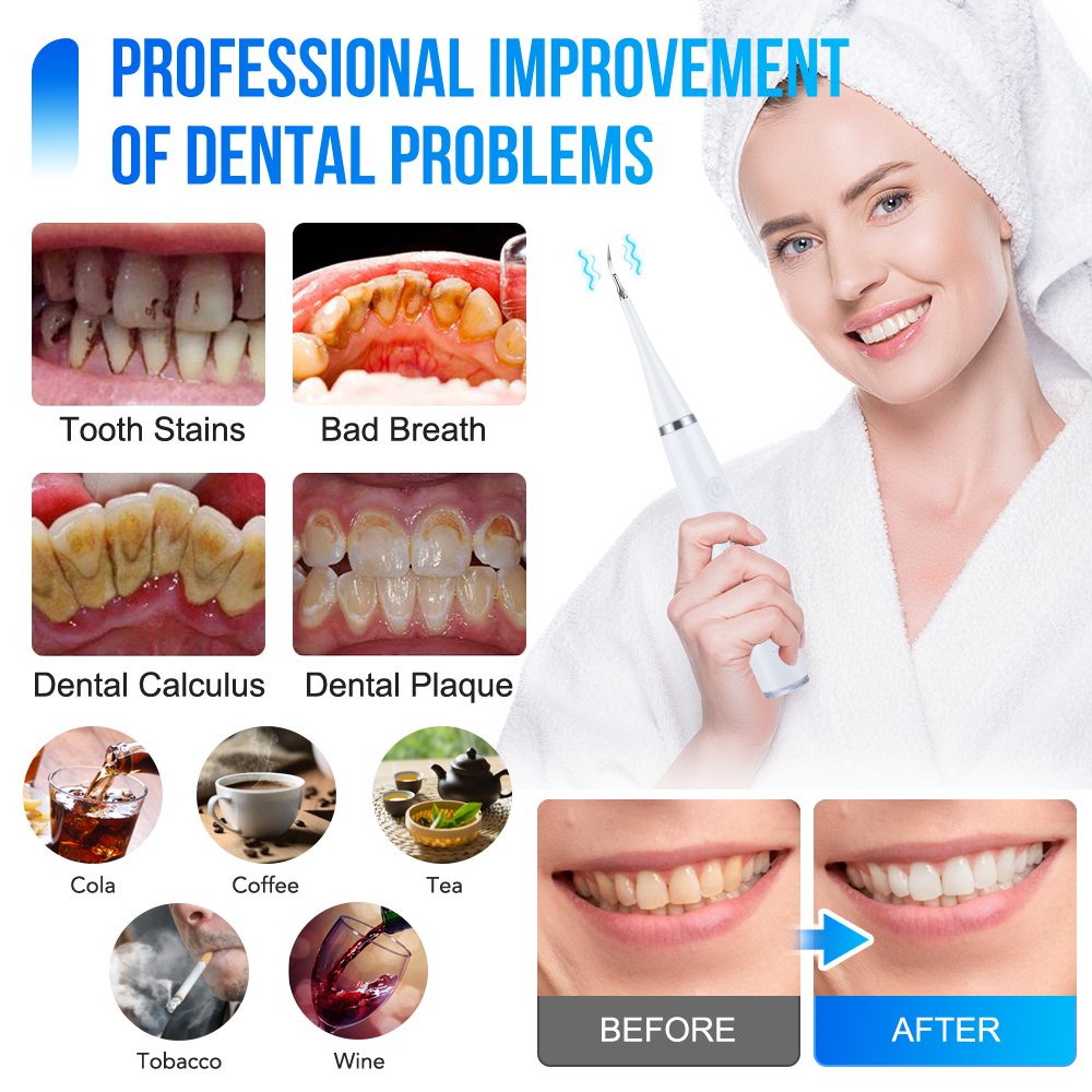 Household Electric Teeth Clean - Teeth Whitening Or Tooth Whitening 评论和价格