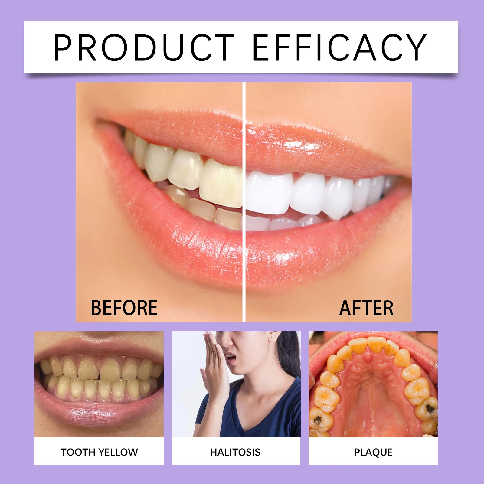 Teeth Whitening Pen Teeth Gel  - Teeth Whitening Bleaching Kit 评论和价格