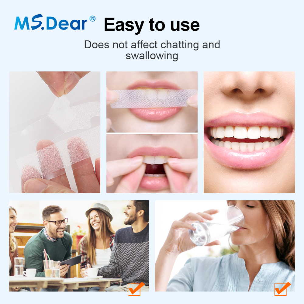 Teeth Whitening Strips Cleansi - Teeth Whitening Diy 评论和价格